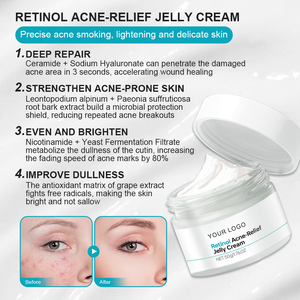 Crema de gelatina de retinol para eliminar el acné, fórmula no comedogénica de ceramida <span class=keywords><strong>Aqua</strong></span>, previene los brotes, se desvanece, cicatrices, piel sensible, amigable - Product Image 3