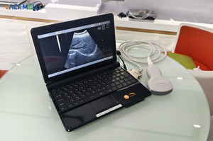 Appareil d'échographie vétérinaire portable à faible coût JM-808S pour clinique vétérinaire et soins aux animaux - Product Image 6