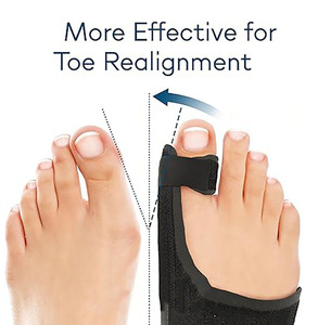 Corrector de juanetes y enderezador de dedos para Hallux Valgus, férula con separador de dedos para aliviar el dolor (<span class=keywords><strong>L</strong></span>/R) - Product Image 2