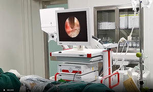 Appareil de caméra endoscopique, portatif au bureau, pour hystophiles, al evt, animaux de compagnie, chiens et chats - Product Image 5