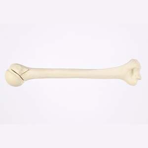 Kyrenmed cortical <span class=keywords><strong>humerus</strong></span> ขวา fractureed กับ <span class=keywords><strong>proximal</strong></span> <span class=keywords><strong>humerus</strong></span> <span class=keywords><strong>fracture</strong></span> สำหรับการประชุมเชิงปฏิบัติการการตัดเจาะ - Product Image 1