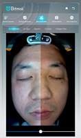 Analyseur de peau du visage par IA, imagerie faciale 3D, machine d'analyse de la peau avec scanner facial intelligent pour salon de beauté professionnel, soins de la peau