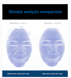 Analizador de Piel Digital 3D en Oferta, Espejo Mágico con Escáner Facial, Detección con Inteligencia Artificial, Conexión WiFi, para Uso Comercial - Product Image 5