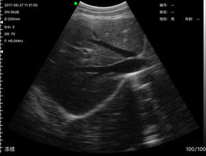 Sonde convexe à ultrasons sans fil Wifi B/W avec système Android, <span class=keywords><strong>mini</strong></span> scanner à ultrasons portable pour l'abdomen - Product Image 5