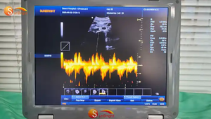 Doppler pulse wave 15 inci Pemasok perangkat medis <span class=keywords><strong>ultrasound</strong></span> 3D rumah sakit - Product Image 3