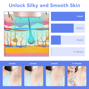 Dispositivo de Belleza Portátil <span class=keywords><strong>Notime</strong></span>, Resistente al Agua, con Batería, Depiladora Permanente Indolora 3 en 1 IPL para Rostro y Axilas - Product Image 4