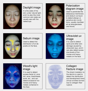 Hot Sale 3D Digital Skin Analyzer Magic Mirror Facial Scanner with AI Intelligence Detection WiFi Enabled for Commercial Use - Product Image 2