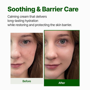 Espuma Limpiadora Facial Hipoalergénica para el Tratamiento del Acné, para Todo Tipo de Piel - Product Image 4