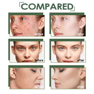 JAYSUING Sérum pour le visage à la racine de réglisse de marque privée, huile essentielle anti-âge éclaircissante pour la peau - Product Image 6