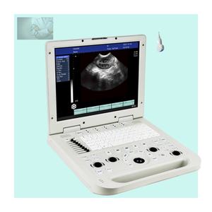 Draagbare Zwart-Witte <span class=keywords><strong>Laptop</strong></span> Ultrasone Scanner Machine Veterinair Instrument Zwart-Wit Echografie - Product Image 1