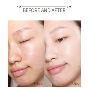 Anti-Aging Gezichtsserumcapsules Sterk Geconcentreerde Huidverzorgingscapsule Voor Eenmalig Gebruik Voor Het Verstevigen Van Rimpels Oem/Odm - Product Image 3