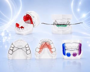 Plaque d'expansion orthodontique <span class=keywords><strong>dentaire</strong></span> de classe II, <span class=keywords><strong>appareil</strong></span> amovible en acrylique avec vis d'expansion personnalisable - Product Image 1