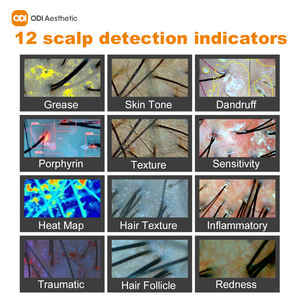 Analyse du cuir chevelu appareil de beauté testeur de cheveux analyseur de peau tricoscope microscope capillaire numérique analyseur de cuir chevelu analyseur de cheveux Machine - Product Image 5