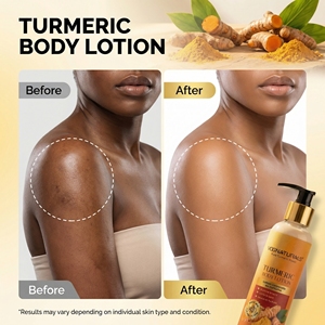 Lotion Corporelle Éclaircissante au Curcuma Pur Bio, Crème <span class=keywords><strong>Hydratante</strong></span> Apaisante Végane pour Femmes, Atténuation des Taches Brunes, Vente en Gros - Product Image 4