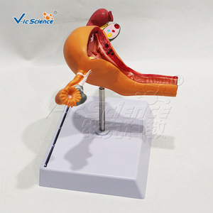 Modelo patológico uterino femenino, modelo anatómico de órgano reproductor ginecológico, molde para enseñanza y formación médica. - Product Image 4