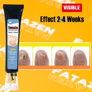 <span class=keywords><strong>Crema</strong></span> de reparación de <span class=keywords><strong>uñas</strong></span> hidratante profunda de etiqueta privada para <span class=keywords><strong>manos</strong></span> y pies OEM cuidado del cuerpo eficaz <span class=keywords><strong>crema</strong></span> de tratamiento de <span class=keywords><strong>hongos</strong></span> en las <span class=keywords><strong>uñas</strong></span> - Product Image 2