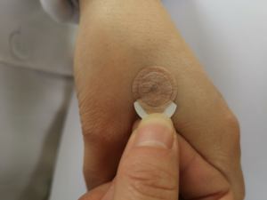 18 aiguilles jetables stériles pour l'acupuncture - Product Image 5