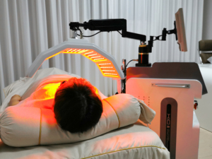 Máquina de Rejuvenecimiento Facial de Última Generación para Uso Doméstico, para Reparar la Piel Envejecida, Piel Propensa al Acné, Aclarar Manchas y Aliviar Quemaduras Solares - Product Image 6