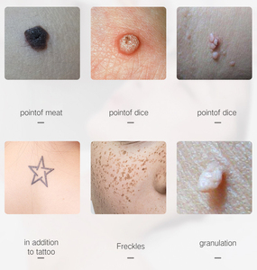Dispositif portatif professionnel de dissolvant de tache de stylo d'enlèvement de taupe de 9 niveaux pour le traitement de tache de rousseur d'étiquette de peau de salon et de maison - Product Image 5