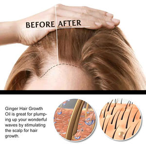 Ormula-sistema de ventilación para el hogar, sistema de ventilación para el aire - Product Image 4