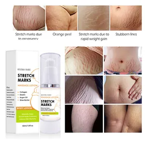 Cream Private OEM Label Pregnancy SkincareMoisturizing Stretch Mark Cream With Probiotic Improving Skin Elasticity Stretch Mark Cream