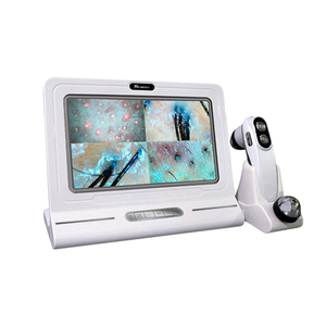 2026 New Professional Scalp Analyzer 50x/200x Hair Lens, Hair and Skin Analyzer Eight Core Four-Spectrum Hair Follicle Detection - Product Image 2