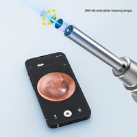 Otoscope intelligent de haute qualité et sûr, 5 mégapixels HD, visuel, portable, alimenté par batterie, appareil de soin des oreilles pour enfants