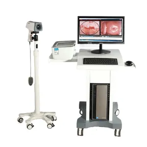 Kernel factory supply cheap Digital Electronic Colposcope / Trolly Type video colposcope for gynecology vagina examination