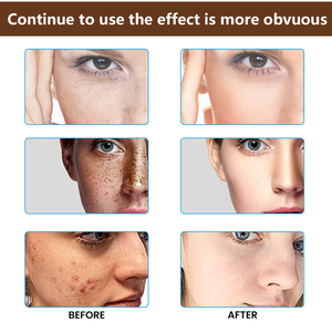 <span class=keywords><strong>Crema</strong></span> facial de cúrcuma para la eliminación del acné Cuidado DE LA PIEL Brillo Reafirmante e hidratante en stock - Product Image 4