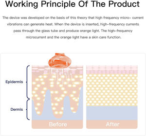 מכונת פנים-יד תדר נייד עבור שיער, גירוי הקרקפת וטיפול בעור, ציוד יופי לשימוש ביתי - Product Image 5