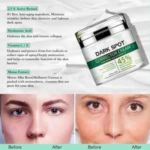 Private Label best whitening freckle cream removal melasma fade <span class=keywords><strong>dark</strong></span> - Product Image 5