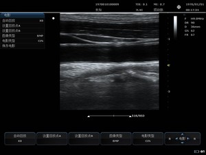 SONOIMAGE N38 Échographe <span class=keywords><strong>Doppler</strong></span> Couleur Vétérinaire Haute Définition Exquis, Adapté aux Petites Parties <span class=keywords><strong>et</strong></span> à l'Échographie Cardiaque Fœtale - Product Image 4