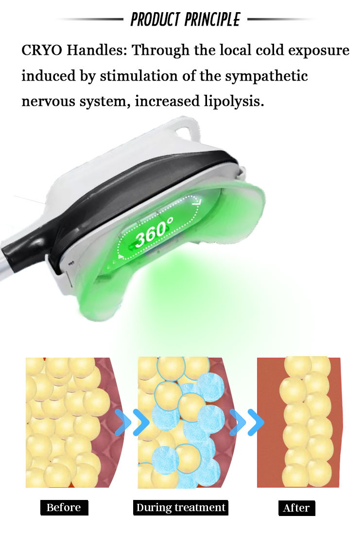 2022 Professional fat burning muscle building hiemt machine cellulite removal weight loss 360 cryo machine