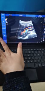 Sonde Doppler USB à prix d'usine, sonde d'échographie <span class=keywords><strong>portable</strong></span> de type C pour usage humain ou <span class=keywords><strong>animal</strong></span> - Product Image 6