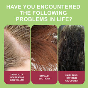 Huile Capillaire Croissance Cheveux à l'Oignon 100ml OEM Marque Privée Sulfure Boost Végétalienne Anti-Frisottis Hydratante - Product Image 5