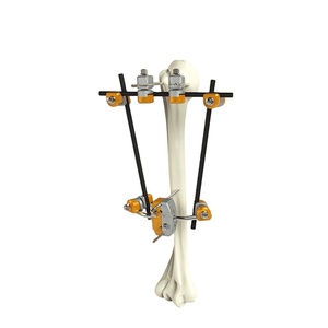 Fijador Externo Hoffman para Fracturas Óseas Ortopédicas, Combinación para Miembro Superior, Húmero <span class=keywords><strong>Proximal</strong></span> - Product Image 1
