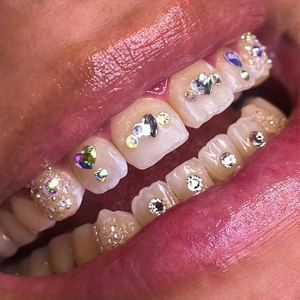 Strass Dentaires Cœur Rouge DIY, Bijoux de Dents Sans Plomb, Goutte Transparente avec Apprêt pour Pose à Domicile - Product Image 1