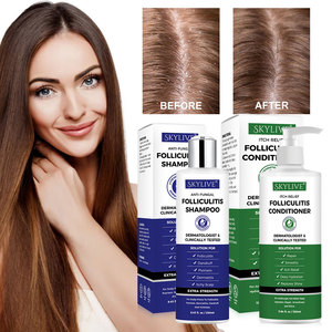 Champú para Eccema y Psoriasis de Marca Blanca, Alivio Anticaspa para Cuero Cabelludo Seco y con Picazón, Fórmula Libre para Cuero Cabelludo Sensible, Hipoalergénico - Product Image 4