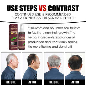 Atomizador de aire, - Product Image 5