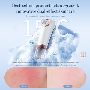 Aspirateur de points noirs chaud/froid, nettoyeur de pores, 3 niveaux, 4 têtes de remplacement, appareil électrique d'aspiration pour le soin de la peau du visage - Product Image 5