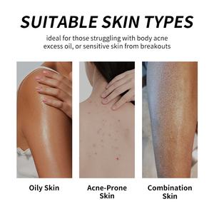 Jabón en Barra Remedy con Aceite de Árbol de Té, Gel de Ducha Natural con Menta y Aloe para el Cuerpo, Elimina el Olor de Pies y Piel Irritada, Alivia la Picazón - Product Image 6