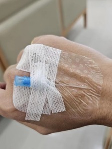 5*5.7cm Transparan Pediatric I.V. Perban Luka, Perban <span class=keywords><strong>Film</strong></span> Transparan dengan Bingkai - Product Image 2