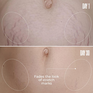 Nhãn hiệu riêng bụng friming Kem Brazil peppertree Kem lâm sàng đã được chứng minh mất dần vết rạn da mượt mà bụng Kem - Product Image 1