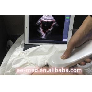 High Speed on Scan and Process (2s) Handheld Mini 4d Wireless Ultrasound Bladder Scanner B10 - Product Image 3