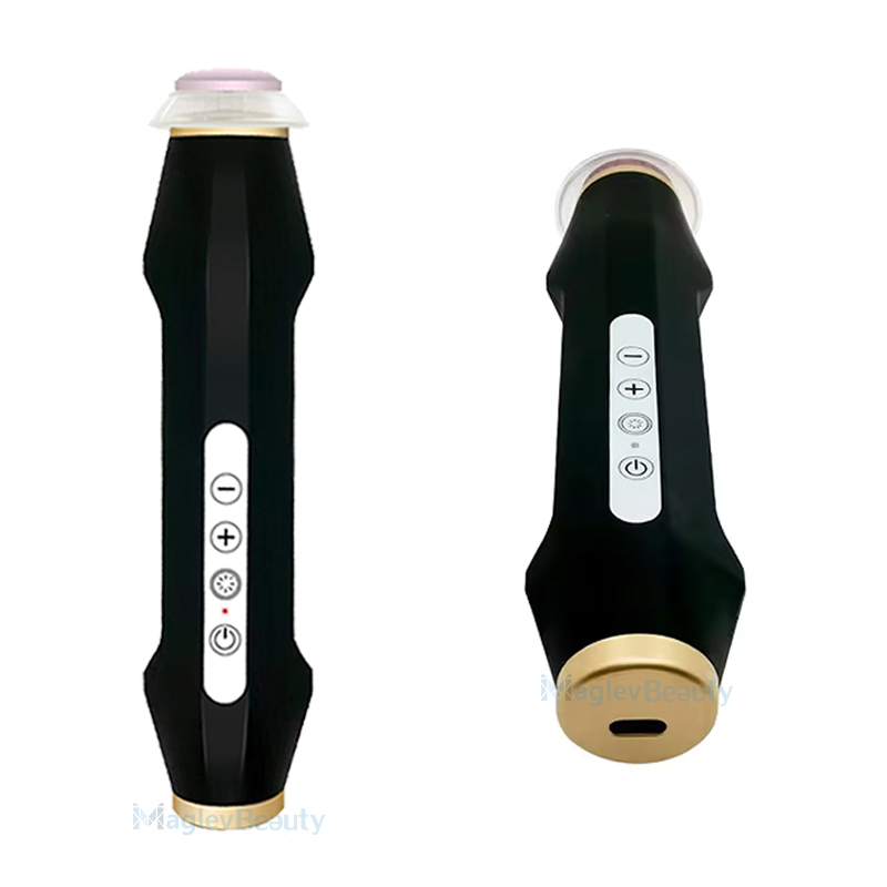 Conexión