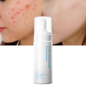 Limpiador Facial Coreano OEM, Control de Grasa, Lavado Facial para Mujeres, Espuma de Aminoácidos - Product Image 1