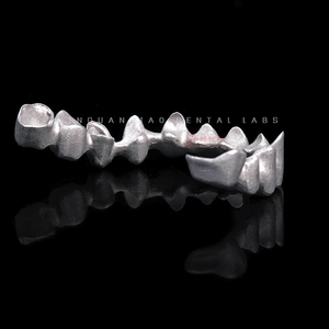 Tecnologia di stampa Laser 3D per cliniche dentali personalizzate corone e ponti in Cina laboratorio dentale - Product Image 1