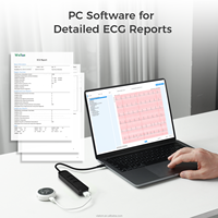 Moniteur Holter ECG portable Wellue Lepod Pro, design ultra-léger 50g, moniteur ECG portable 12 pistes