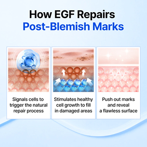 Suero Antienvejecimiento Concentrado con Péptidos, EGF y bFGF para la Recuperación Nocturna y el Cuidado de Líneas Finas, Guaiazuleno Azul Natural - Product Image 4