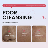 Masque en stick à l'argile volcanique et à l'armoise, marque privée, nettoyage en profondeur, contrôle du sébum, hydratant, masque facial, fabricant en gros